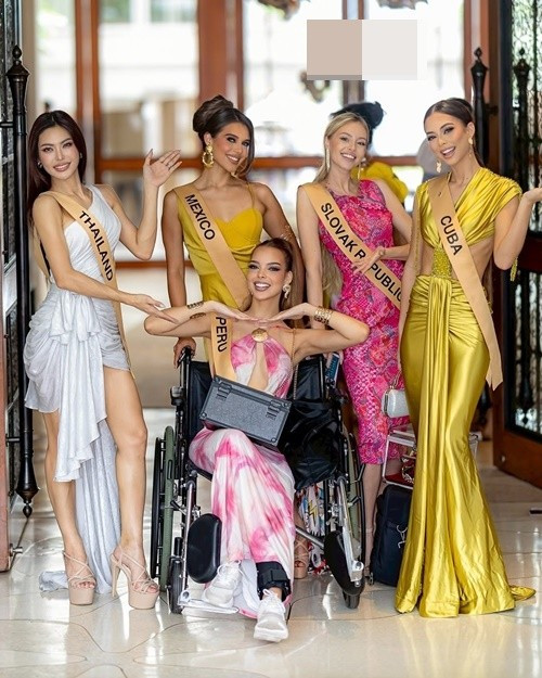 Bác sĩ khuyên đại diện Peru phải sử dụng nạng trong khoảng 1 tuần để phục hồi.