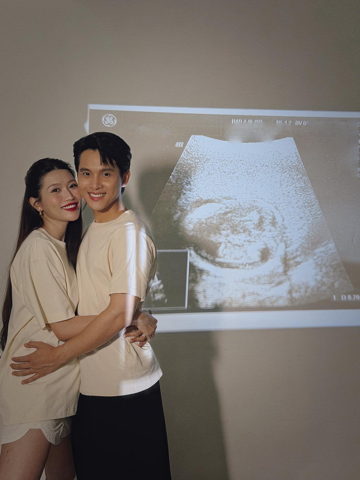 Á hậu Hòa bình Việt Nam 2022 chuyển về sống cùng bố mẹ chồng khi mang thai bởi chồng cô - doanh nhân Phát Nguyễn thường xuyên công tác xa nhà. Ảnh: FB Quỳnh Châu.