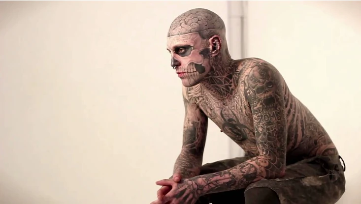 Cuộc đời bi thảm của thanh niên “xác sống” duy nhất trên thế giới