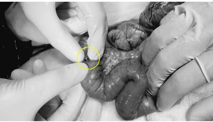 Video: Nuốt loại đồ chơi xếp hình quen thuộc, trẻ ba tuổi thủng ruột