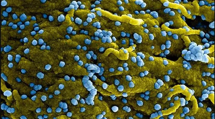 Video: WHO tuyên bố đợt bùng phát loại virus mới, tỉ lệ tử vong tới 90%