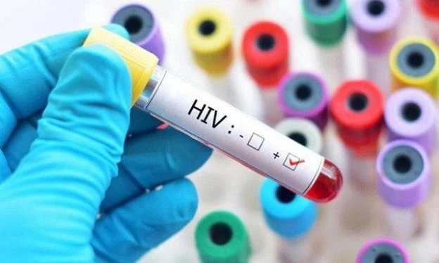 Điểm danh những yếu tố khiến việc điều trị HIV thất bại