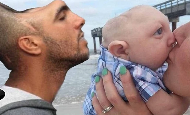 Bí ẩn người không não vẫn sống khỏe mạnh, có chỉ số IQ cực cao