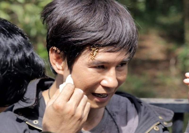 Khi đóng Lật mặt 2, Lý Hải liên tục gặp tai nạn. Anh bị khâu năm mũi ở trán sau khi ngã đập đầu vào máy quay phim trong pha hành động trên xe. Ảnh: Pháp luật TP HCM.