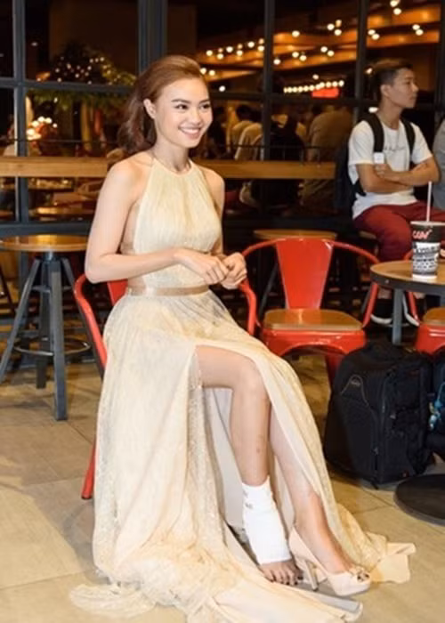 Trong một pha rượt đuổi phim Găng tay đỏ, do không phanh kịp, Ninh Dương Lan Ngọc bị ngã, va chạm khiến chân bị móc ngược vào bánh xe. Lan Ngọc bị gãy xương chân, phải bó bột. Ảnh: Znews.