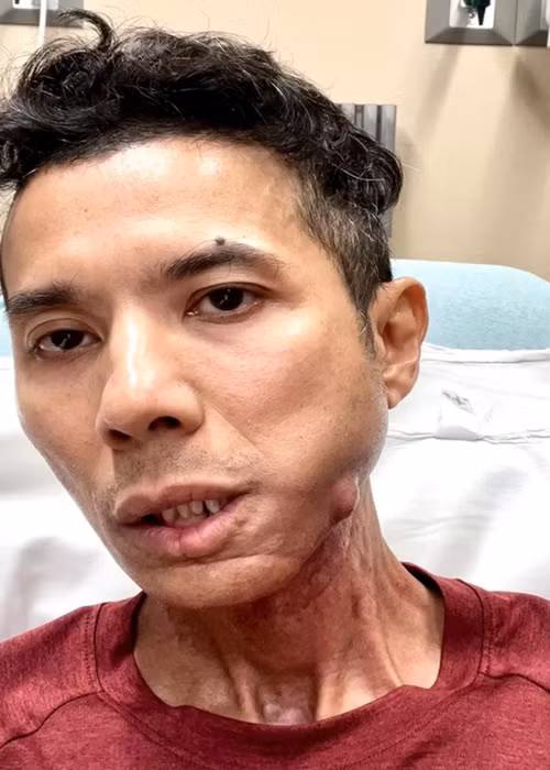 Hơn tháng qua, Kasim Hoàng Vũ đau đớn, đêm nào cũng thức đến sáng. Ảnh: Vietnamnet.