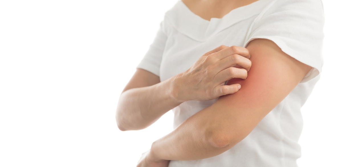 Bước 3: Uống thuốc chống dị ứng không kê đơn. Lưu ý: Đọc nhãn của thuốc một cách cẩn thận để đảm an toàn cho sức khỏe. Ảnh: netdna.