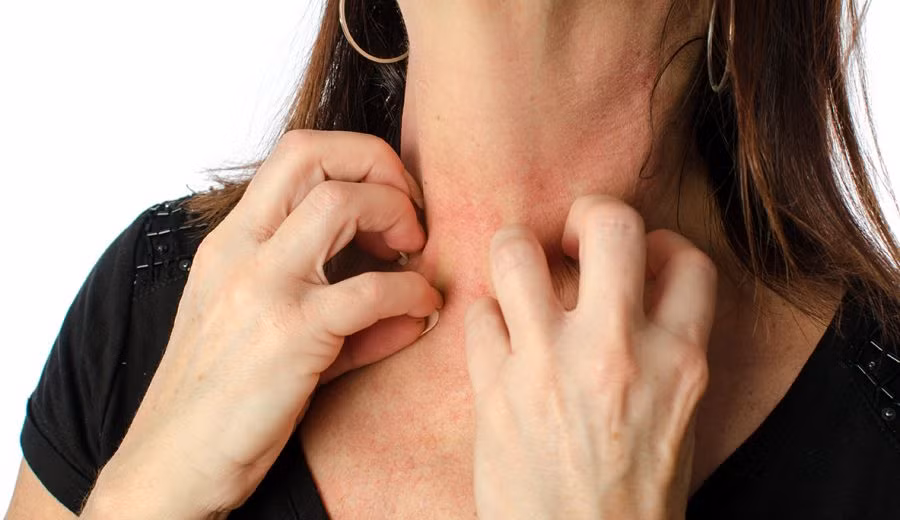 Ngoài ra, nếu bạn ở khu vực nhiều dị ứng nguyên như nấm mốc, hãy đóng cửa sổ và cửa ra vào để ngăn bào tử nấm mốc xâm nhập vào nhà bạn. Ảnh: nationaleczema.