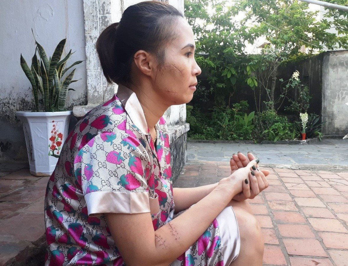 Khoi to vu chong xong vao xuong may dam vo-Hinh-2