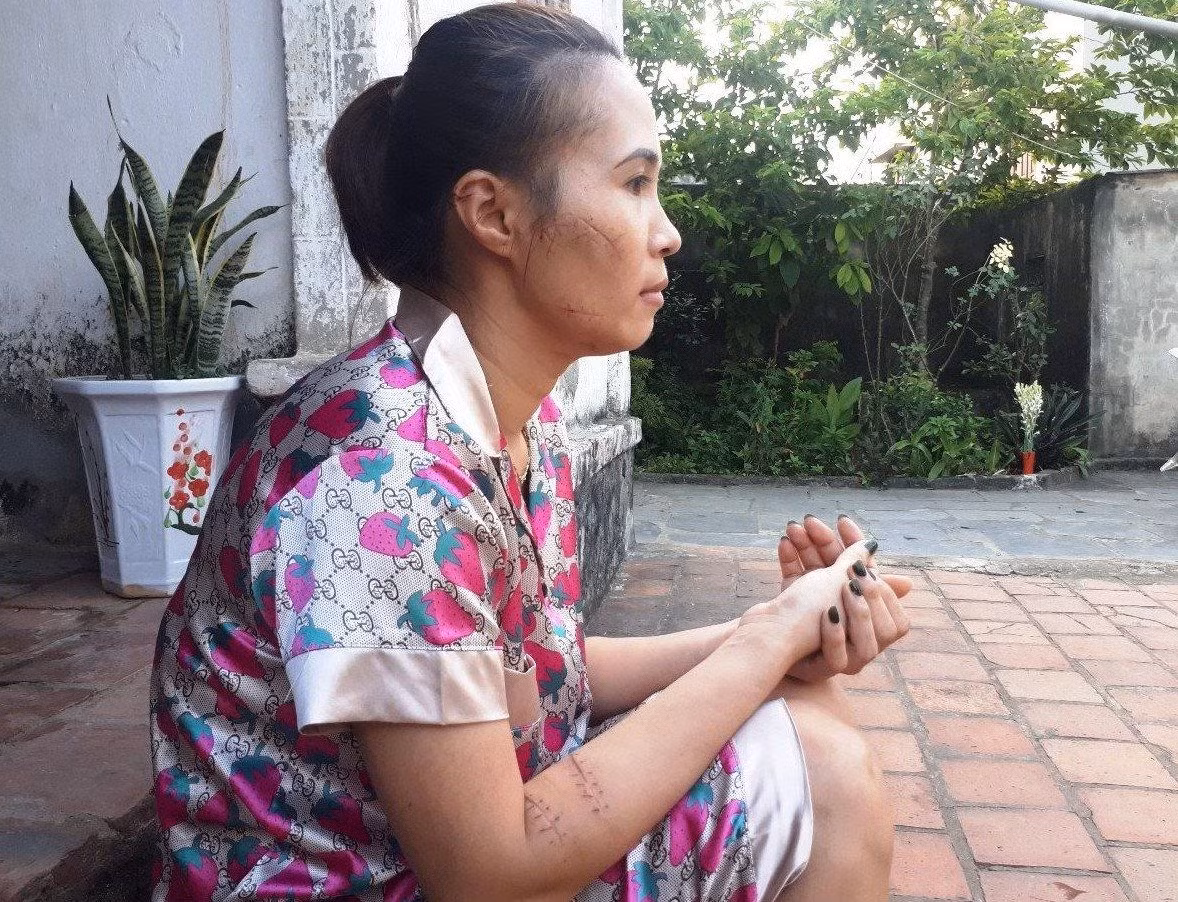 Khoi to vu chong xong vao xuong may dam vo-Hinh-2