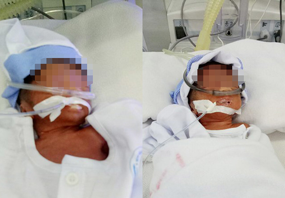 Đau đẻ lúc giãn cách xã hội, được công an đưa cấp cứu kịp: Chiều 19/7, lãnh đạo Công an phường Mỹ Thạnh, TP Long Xuyên (An Giang) cho biết, trực ban của đơn vị vừa kịp thời xử lý thông tin và đưa sản phụ Nguyễn Thị Trang (29 tuổi, ngụ khóm Thới Hòa) đến bệnh viện hạ sinh 2 bé gái an toàn.