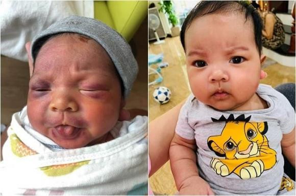 Con ut Hai Bang tung sinh non gio ra sao?