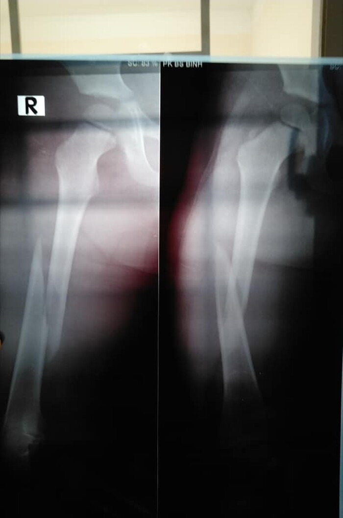 Be 4 tuoi gay chan o lop, co giao noi ly do gay buc xuc-Hinh-3