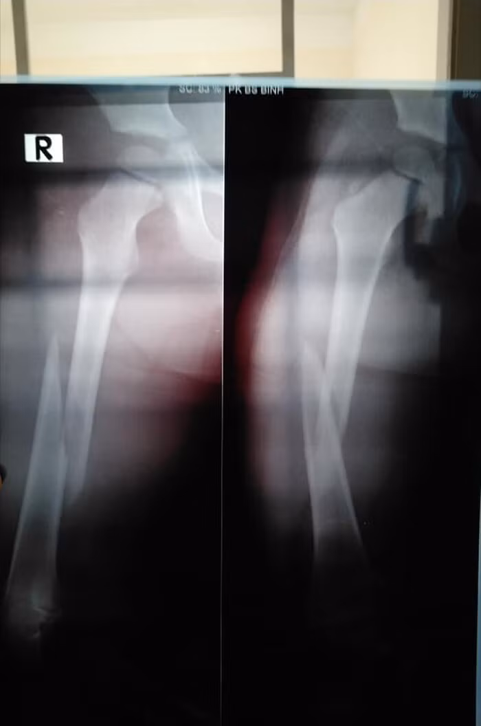 Be 4 tuoi gay chan o lop, co giao noi ly do gay buc xuc-Hinh-3