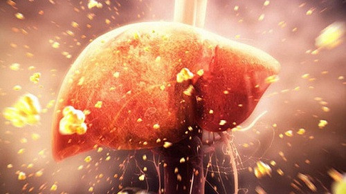 Lá gan nhiễm độc – Ảnh minh họa