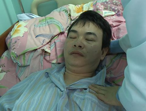 Cũng đang điều trị tại bệnh viện Nhiệt đới TW, bệnh nhân này được chẩn đoán viêm màng não mủ do nhiễm liên cầu khuẩn lợn.