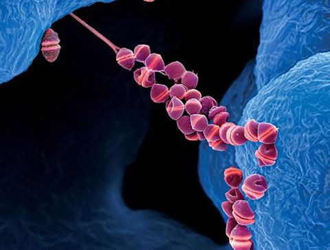 Tác nhân gây bệnh là liên cầu streptococcus, có thể tồn tại cả trong lợn khỏe và lợn bệnh