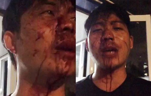 Cu dan Opal Riverside cua Dat Xanh “to” bi bao ve danh trong thuong