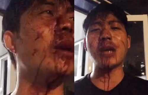 Cu dan Opal Riverside cua Dat Xanh “to” bi bao ve danh trong thuong