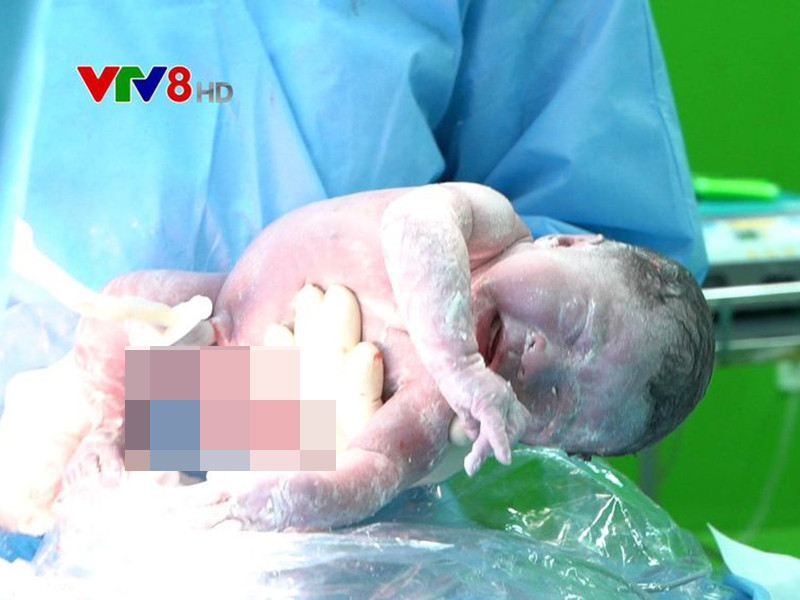 Ở hạng mục Hình ảnh thời sự ấn tượng, ê-kíp “Khoảnh khắc kì diệu giữa tâm dịch bệnh” của VTV8 đoạt giải. Phóng sự ghi lại khoảnh khắc chào đời của em bé giữa thời điểm dịch bệnh diễn biến căng thẳng ở Đà Nẵng. Các bác sĩ đã thực hiện ca mổ đẻ cho bệnh nhân COVID-19 số 569.