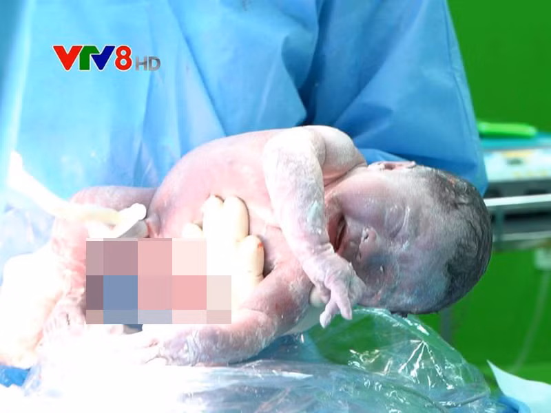 Ở hạng mục Hình ảnh thời sự ấn tượng, ê-kíp “Khoảnh khắc kì diệu giữa tâm dịch bệnh” của VTV8 đoạt giải. Phóng sự ghi lại khoảnh khắc chào đời của em bé giữa thời điểm dịch bệnh diễn biến căng thẳng ở Đà Nẵng. Các bác sĩ đã thực hiện ca mổ đẻ cho bệnh nhân COVID-19 số 569.