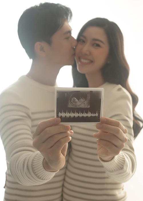 Cặp đôi xác nhận tin vui ngay trong đám cưới.