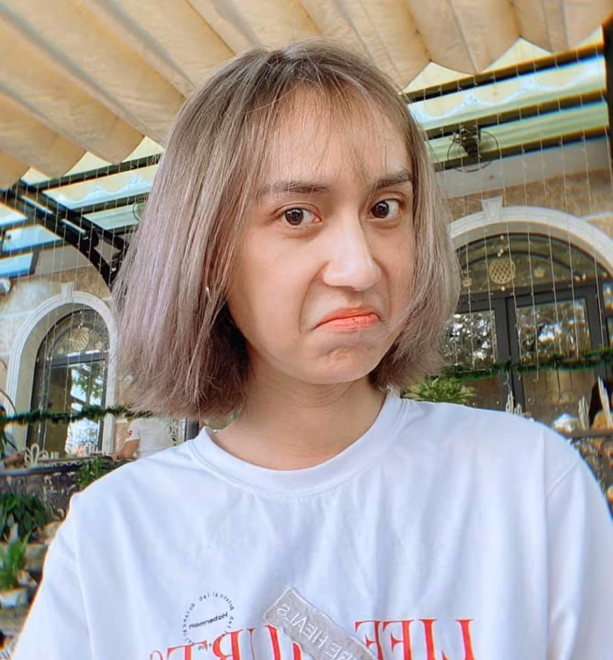 Giọng ca "Tạm biệt nhé" cũng công khai chia sẻ trước khán giả rằng mình có can thiệp thẩm mỹ để hoàn thiện vẻ ngoài. Cụ thể, anh có tiêm má baby, sửa mũi, nhấn mí... hết khoảng 200 triệu đồng.