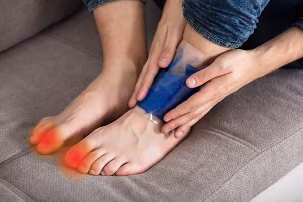Thời điểm nên chườm đá. Bạn có thể chườm đá lạnh sau khi bị tấy, càng sớm càng tốt. Chườm đá lên vùng bị đỏ, sưng, nóng và đau cục bộ.