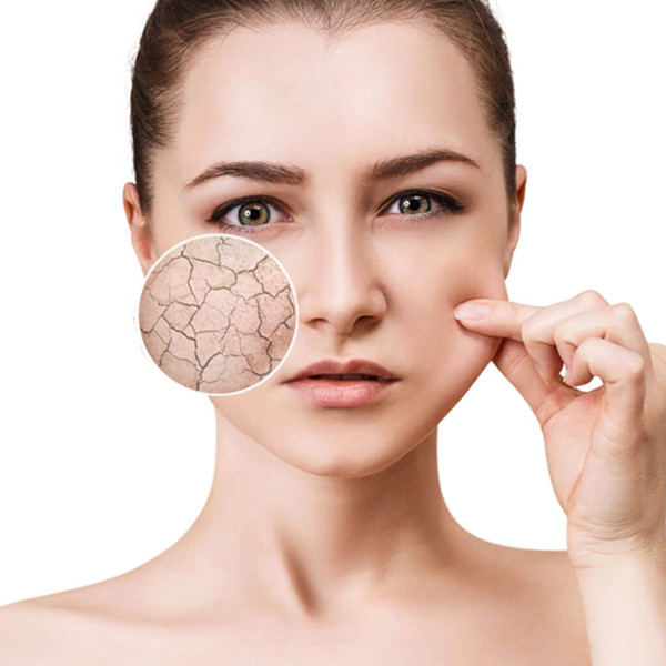 Đồng quan điểm với chuyên gia làm đẹp, bác sĩ da liễu Ailynne Marie Vergara – Wijangco cũng nhấn mạnh: “Nước nóng sẽ lấy đi lớp dầu tự nhiên trên da và đẩy nhanh quá trình tổn thương da”.