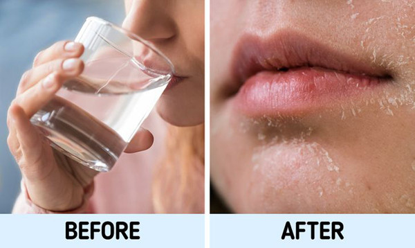 Uống quá nhiều nước. Uống quá nhiều nước là thói quen âm thầm gây khô da đã được kiểm chứng. Nghe có vẻ trái ngược song các nhà khoa học chỉ ra, uống nhiều nước khiến cơ thể mất đi lượng khoáng chất cần thiết. Điều này ảnh hưởng xấu đến làn da, khiến nó trở nên xỉn màu và thiếu sức sống.