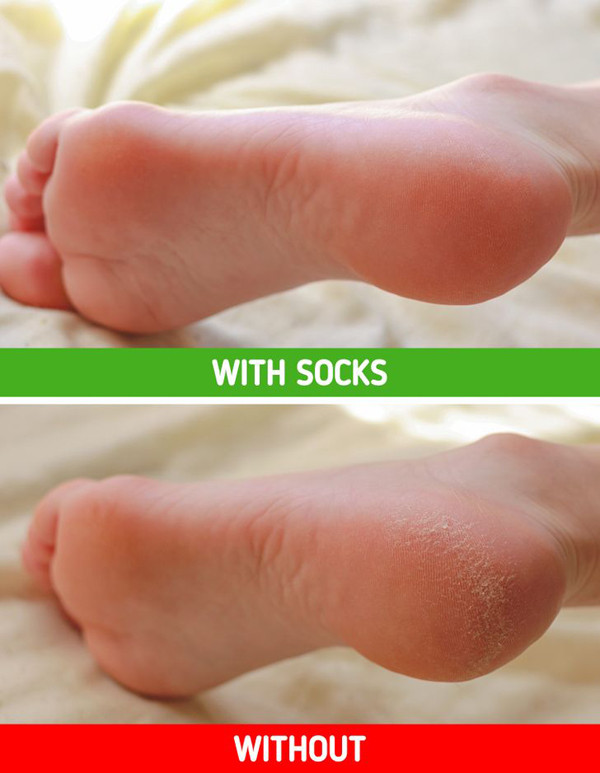 Đi ngủ không đi tất. Hầu hết mọi người có thói quen để chân trần đi ngủ. Tuy nhiên, dùng một chiếc tất mỏng sẽ giúp bạn ngủ ngon hơn, ngăn ngừa tình trạng nứt nẻ gót chân.