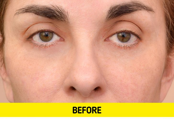 Khiến da dễ bị nhăn. Tắm nước nóng lâu, da các đầu ngón tay sẽ bị nhăn nheo. Điều này bắt nguồn từ việc nước nóng lấy đi độ ẩm trên da, làm hỏng lớp bảo vệ giúp khóa ẩm.