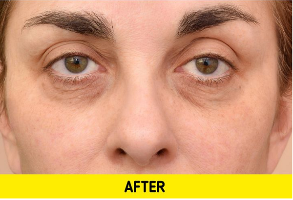 Tương tự, dùng nước nóng từ vòi hoa sen rửa mặt sẽ khiến da dễ bị lão hóa hơn. Lâu ngày, những vết nhăn sẽ sớm hình thành khiến nhan sắc của bạn ngày càng xuống cấp.