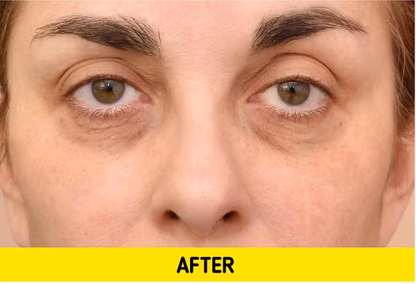 Tương tự, dùng nước nóng từ vòi hoa sen rửa mặt sẽ khiến da dễ bị lão hóa hơn. Lâu ngày, những vết nhăn sẽ sớm hình thành khiến nhan sắc của bạn ngày càng xuống cấp.