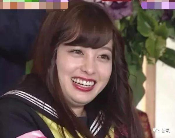 Nếu như trước kia đôi mắt được xem là điểm sáng của Hashimoto thì nay chúng cũng không tràn đầy sức sống như trước.