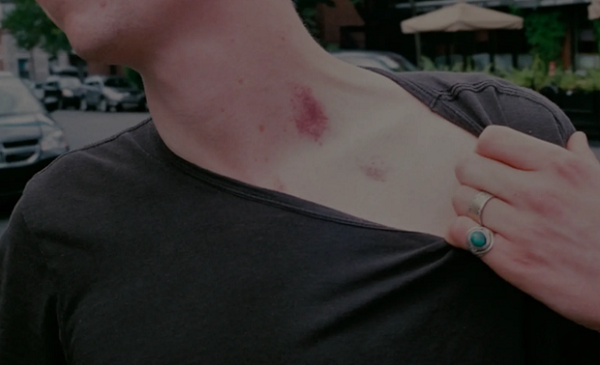 View - Vùng cấm không nên hôn sơ sểnh đoạt mạng thay vì khoái cảm | Báo Tri thức và Cuộc sống - TIN TỨC PHỔ BIẾN KIẾN THỨC 24H