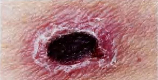 Benh nhan nguy kich, bac si hoang mang cho den khi phat hien vet dom