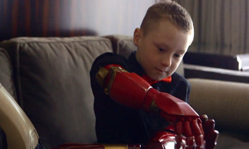 Em be khuyet tat 7 tuoi duoc lap canh tay sieu nhan