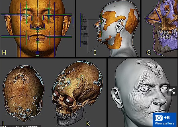 Đặc biệt, vào khoảng 500 năm trước, một số bác sĩ còn sử dụng thủy ngân trong điều trị bệnh giang mai.