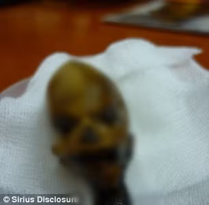 Nhóm chuyên gia thuộc Đại học Standord, Mỹ kiểm tra, phân tích bộ gene của Ata, sơ đồ gene nằm trong nhân tế bào. Kết quả giúp họ xác nhận Ata là con người.