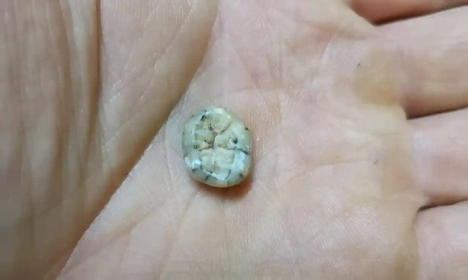 3. Chiếc răng ít nhất 130.000 năm tuổi chứa manh mối mới về loài người. Theo nghiên cứu của các chuyên gia, chiếc răng trên thuộc về một đứa trẻ, có thể là nữ, qua đời kho khoảng 3,5 - 8,5 tuổi, được tìm thấy trong hang Cobra (hay Tam Ngũ Hào 2) của Lào. Việc phân tích hình dạng của chiếc răng cho thấy nói có thể thuộc về người Denisovan sống cách đây từ 164.000 - 131.000 năm.