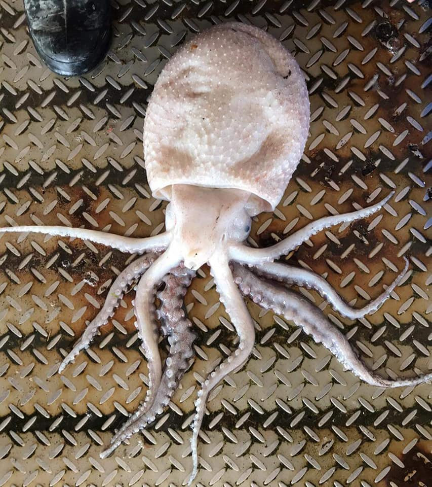 Di cau bach tuoc, sung sot phat hien bien the cuc hiem-Hinh-3