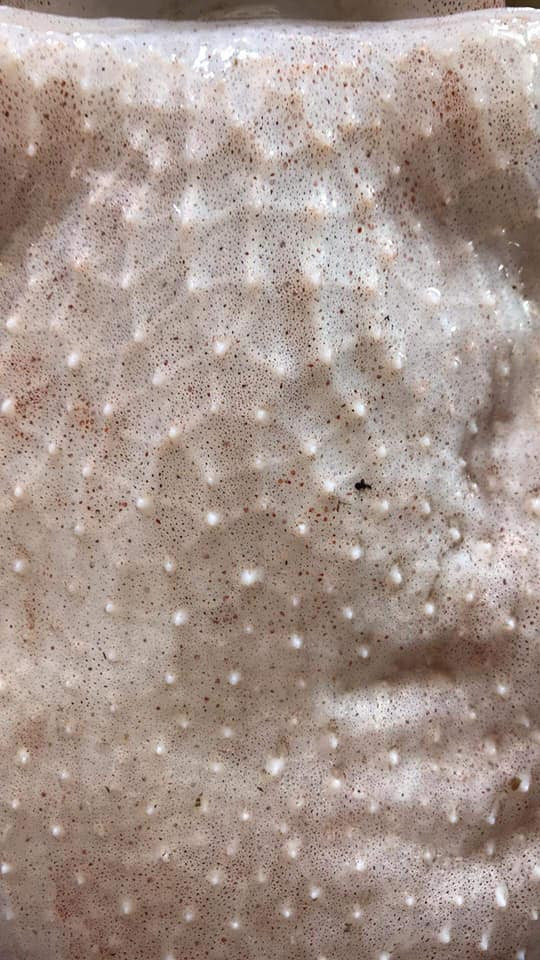 Di cau bach tuoc, sung sot phat hien bien the cuc hiem-Hinh-4