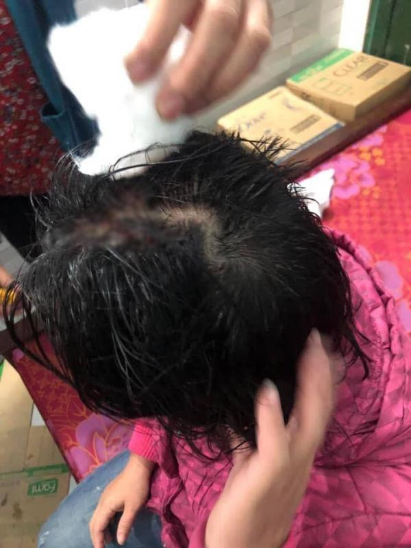 Vo di lam toc don Tet mat 500 ngan, bi chong danh tham te