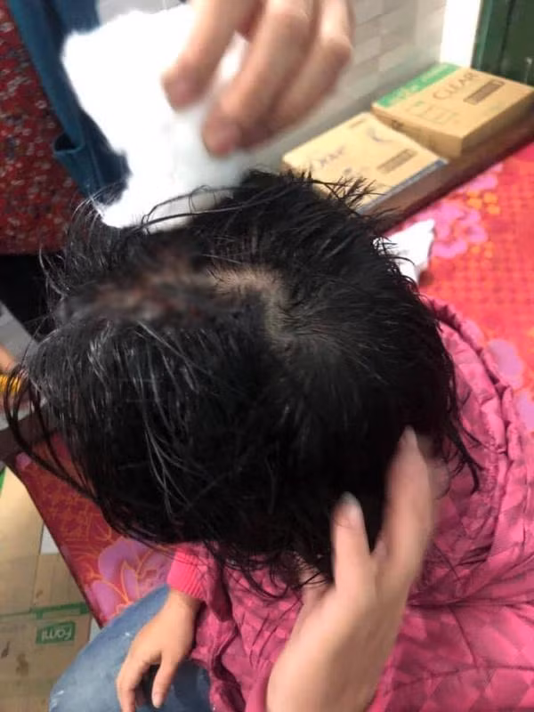 Vo di lam toc don Tet mat 500 ngan, bi chong danh tham te