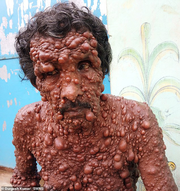 Nguoi dan ong hoa quy, khien dan lang so hai tranh mat va su that dau long-Hinh-2