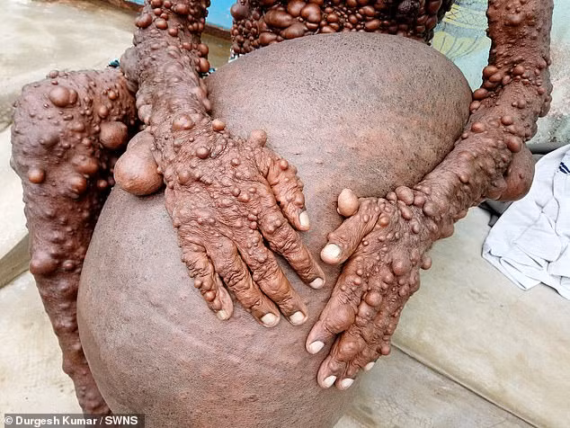 Nguoi dan ong hoa quy, khien dan lang so hai tranh mat va su that dau long-Hinh-3