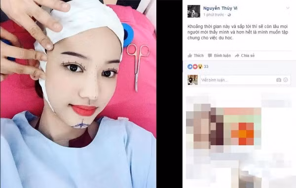 Chỉ trong một khoảng thời gian ngắn, Thúy Vi đã có nhiều bước thay đổi nhanh đến chóng mặt, đặc biệt là về ngoại hình. Cô nàng tai tiếng này không ngại công khai những bức ảnh trong quá trình làm phẫu thuật thẩm mỹ và đã không còn giấu giếm ý định chen chân vào showbiz. Dù chưa biết trong tương lai ngắn, Thúy Vi và những thảm họa mạng 2016 này sẽ có những bước tiến, sự thay đổi như thế nào, chỉ biết ở hiện tại họ đều là những nhân vật bị nhiều người chỉ trích trên mạng xã hội.