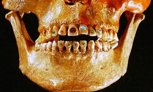 Từ khoảng 2.500 năm trước, những thổ dân ở châu Mỹ đã biết cách gắn đá quý vào răng để làm đẹp. Kết luận này được các chuyên gia đưa ra sau khi nghiên cứu, phân tích vài nghìn mẫu răng gắn đá quý mà họ thu thập được.