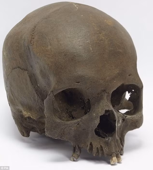 Hộp sọ của một phụ nữ tầm 45 tuổi có niên đại vào cuối thời Đồ đồng.